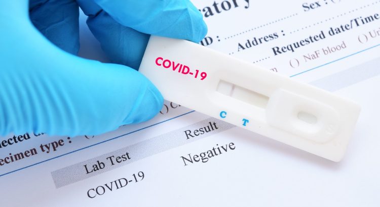 Free Testing-For-Medically-Screened-COVID-19-Cases